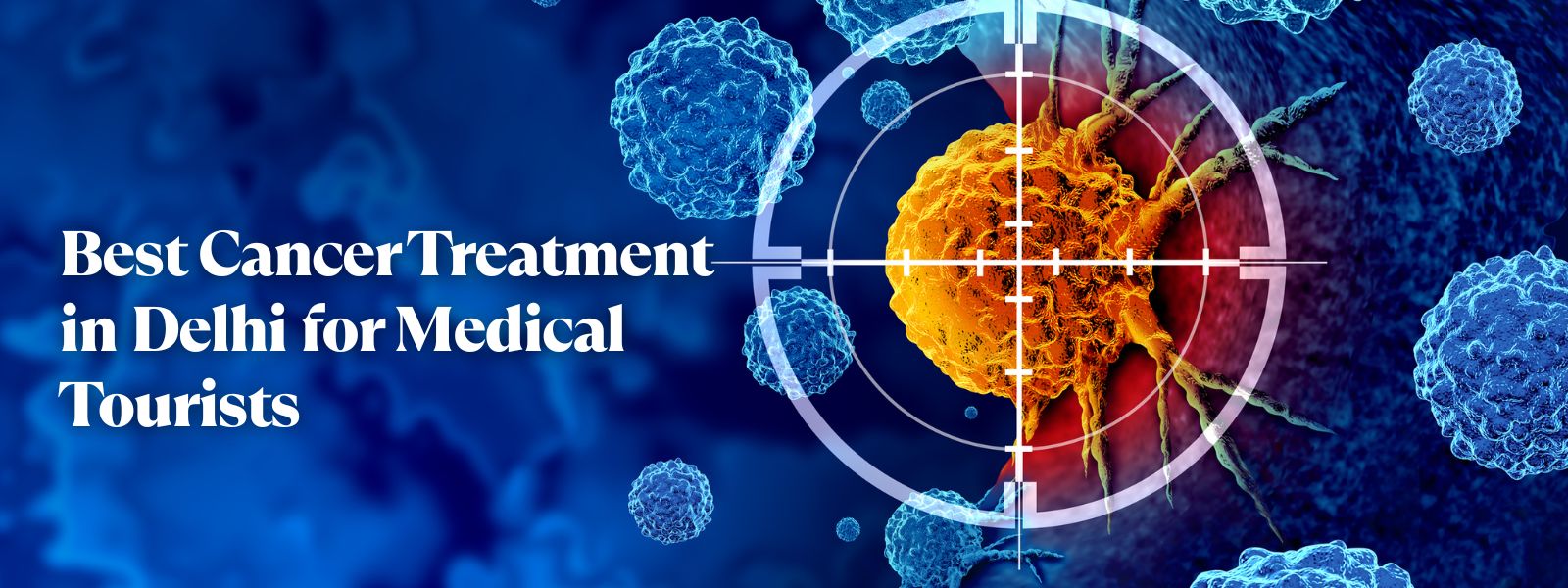 Best Cancer Treatment in Delhi