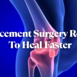 Knee Replacement Surgery