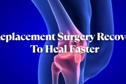 Knee Replacement Surgery